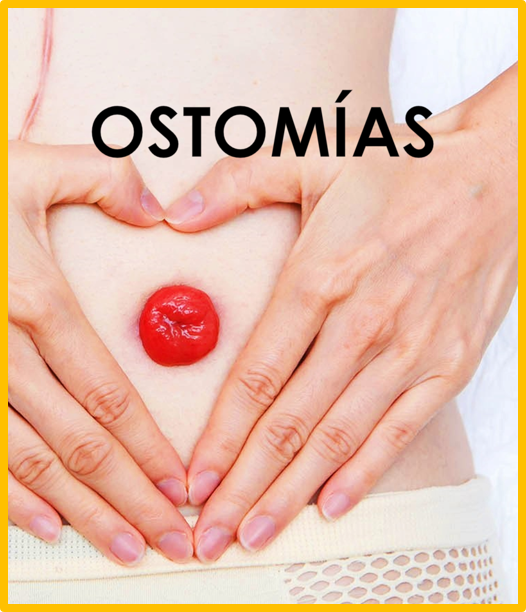 21 - Curso Ostomias para profesionales de enfermería (04/08/2025 - 29/08/2025)